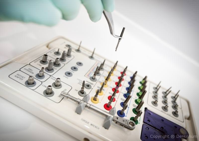 dental implants - procedure