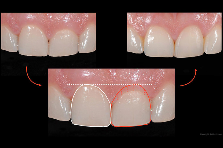 perio treatment